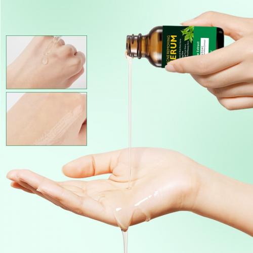 เซรั่มบำรุงผิวหน้า Tea Tree Acne Treatment